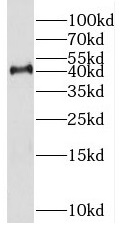 KMT5A antibody|KMT5A抗体
