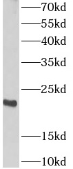 ARPC4 antibody|ARPC4抗体