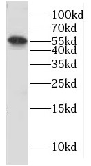 CYP4B1 antibody|CYP4B1抗体