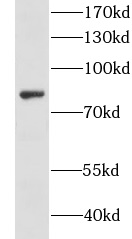 CKAP2L antibody|CKAP2L抗体