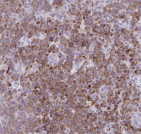 SERPIND1 antibody|SERPIND1抗体