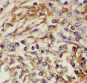 HSP90B1 antibody|HSP90B1抗体 FNa