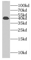 GARIN1A antibody|GARIN1A抗体