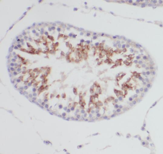 SERPINE2 antibody|SERPINE2抗体 F
