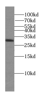 DRAM2 antibody|DRAM2抗体