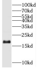 UBE2G2 antibody|UBE2G2抗体