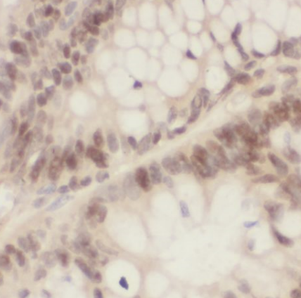 NPM1 antibody|NPM1抗体 FNab00759