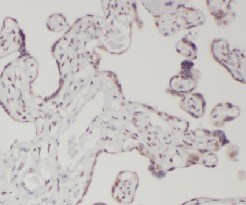 LETM2 antibody|LETM2抗体
