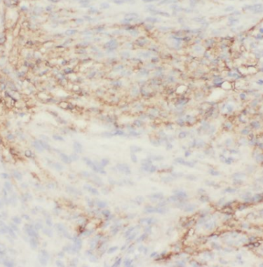 EPHA6-Specific antibody|EPHA6抗