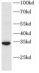 PBDC1 antibody|PBDC1抗体