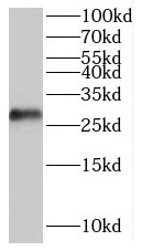 POLR3G antibody|POLR3G抗体
