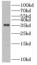 SULT1B1 antibody|SULT1B1抗体