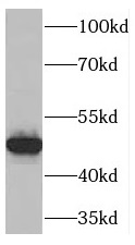 TNFSF13B antibody|TNFSF13B抗体