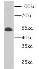 GDPD5 antibody|GDPD5抗体 FNab034