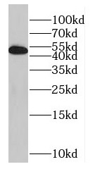 GABPB2 antibody|GABPB2抗体