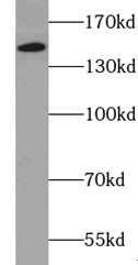 XDH antibody|XDH抗体 FNab09539