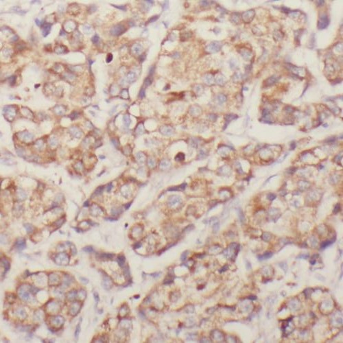 RIOK3 antibody|RIOK3抗体