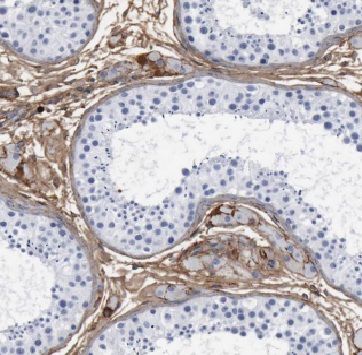 AP2A2 antibody|AP2A2抗体