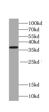 TNFAIP1 antibody|TNFAIP1抗体 FNa