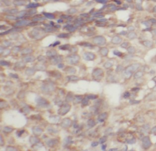 TPM2 antibody|TPM2抗体