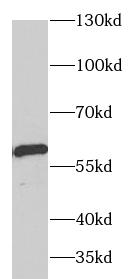 ARSA antibody|ARSA抗体
