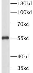 VIM antibody|VIM抗体 FNab09409