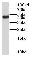 RNF133 antibody|RNF133抗体