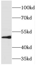 TFAP2B antibody|TFAP2B抗体