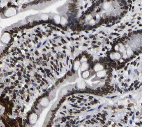 SNRPD3 antibody|SNRPD3抗体