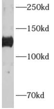 ADCY6 antibody|ADCY6抗体