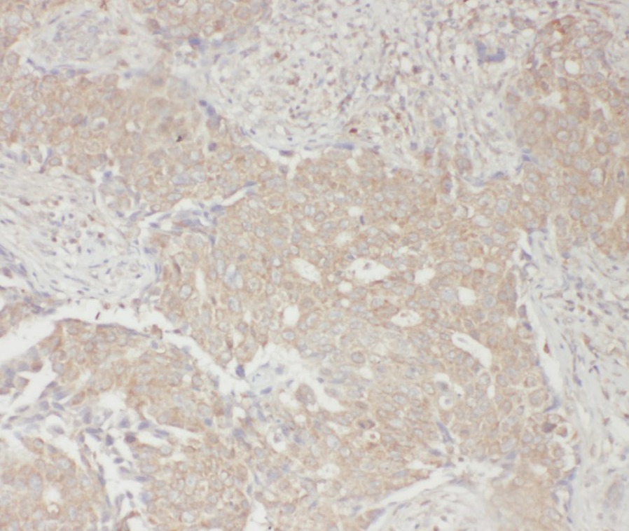 RPS6KB1 antibody|RPS6KB1抗体 FNa