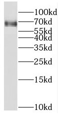 RFX5 antibody|RFX5抗体