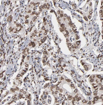 TGDS antibody|TGDS抗体