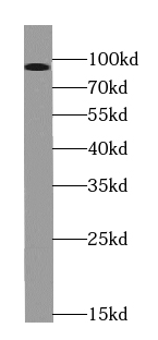 TGFBR3-Specific antibody|TGFBR