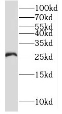 RNF170 antibody|RNF170抗体