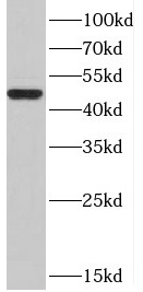 ACKR3 antibody|ACKR3抗体 FNab021