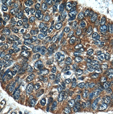 MLPH antibody|MLPH抗体 FNab05120