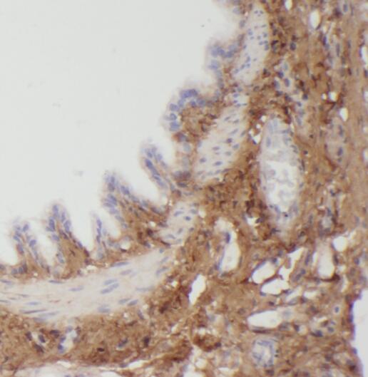 PLEKHO2 antibody|PLEKHO2抗体