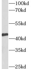 TMX4 antibody|TMX4抗体