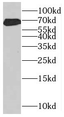 MKS1 antibody|MKS1抗体