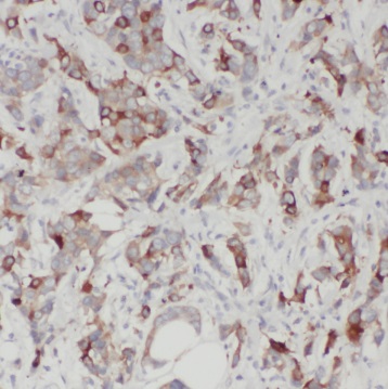 SULT1A3 antibody|SULT1A3抗体