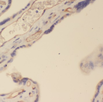PSG4 antibody|PSG4抗体