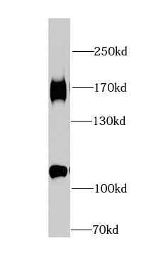 HDAC6 antibody|HDAC6抗体 FNab038