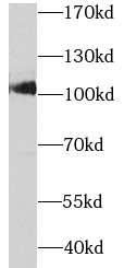 SARDH antibody|SARDH抗体