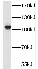 SALL2 antibody|SALL2抗体 FNab075