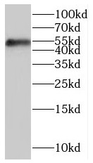 HFE antibody|HFE抗体