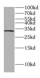 DLX3 antibody|DLX3抗体