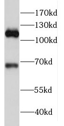 RIPOR2 antibody|RIPOR2抗体