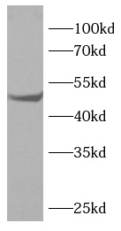 HNF4A antibody|HNF4A抗体