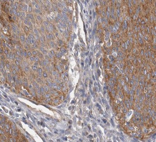 CRNN antibody|CRNN抗体